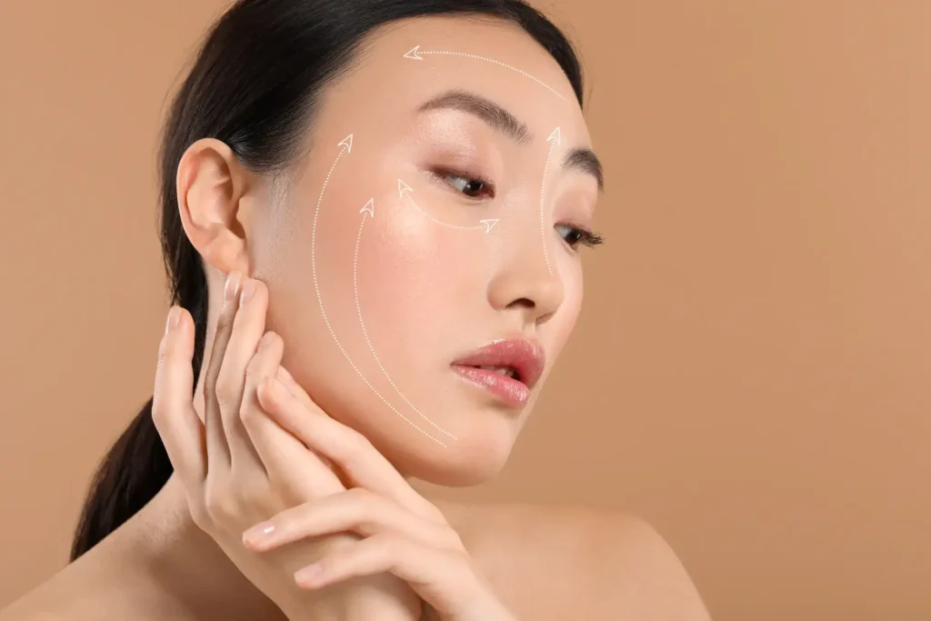 A clinician prepares a patient for a face thread lift by marking the cheek, brow, and jawline areas prior to thread insertion.